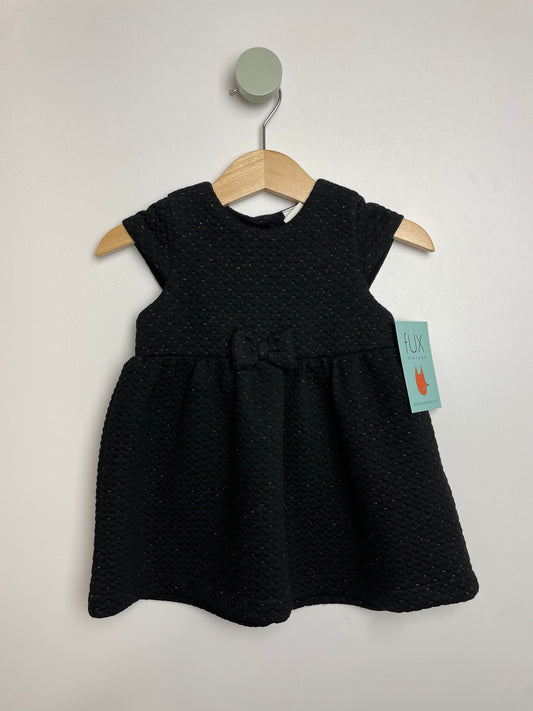 Kleid glitzer • 74 • h&m